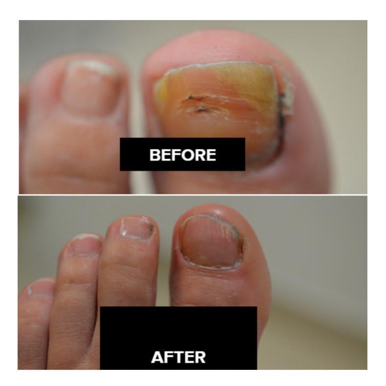 Nail Repair Cream