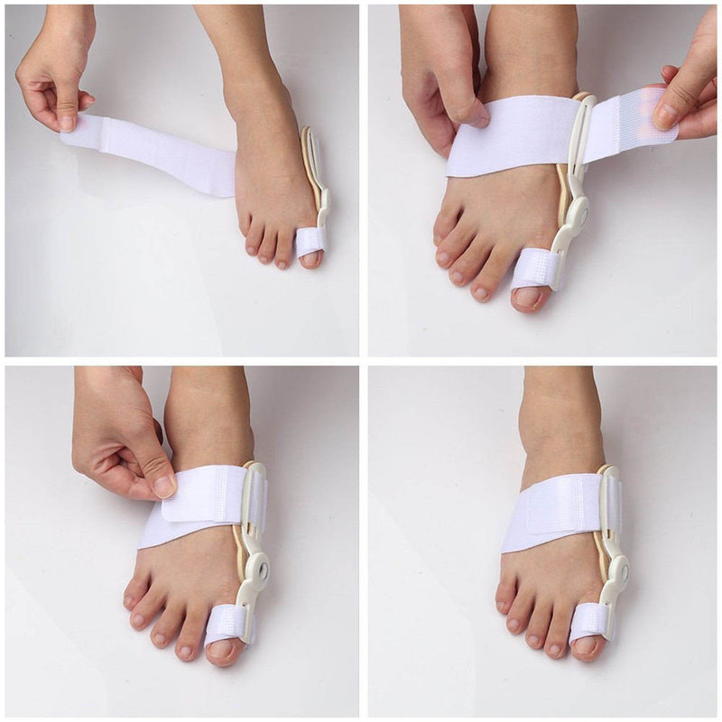 Orthopedic Bunion Corrector