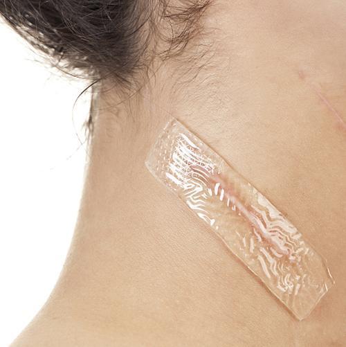 Silica Scar Therapy Patch